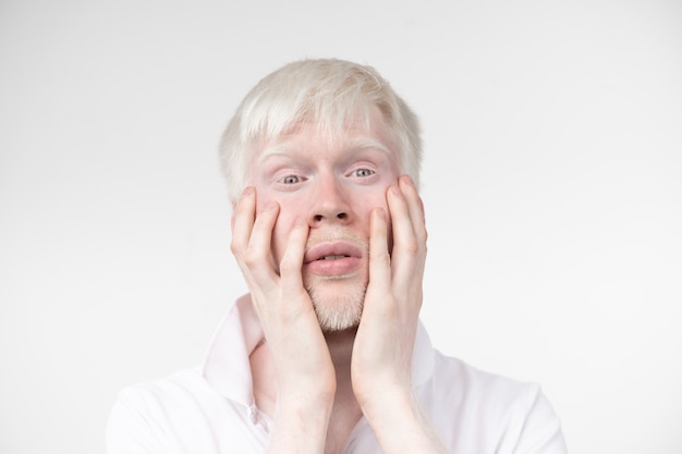 Il ritratto di un uomo dell'albino in studio ha vestito la maglietta isolata su una priorità bassa bianca. deviazioni anormali. aspetto insolito. anomalia della pelle