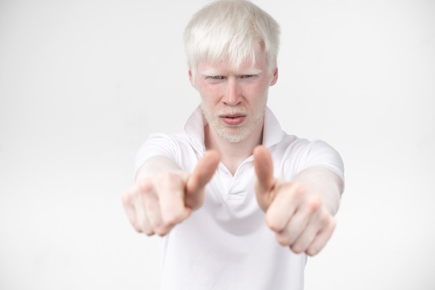 Il ritratto di un uomo dell'albino in studio ha vestito la maglietta isolata su una priorità bassa bianca. deviazioni anormali. aspetto insolito. anomalia della pelle