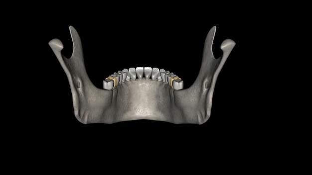 Il secondo molare mandibolare assomiglia al primo molare permanente mandibolare