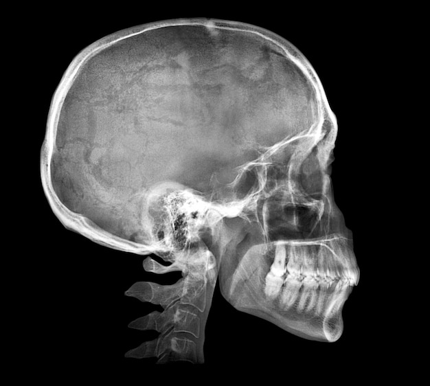 Immagine a raggi x del cranio umano