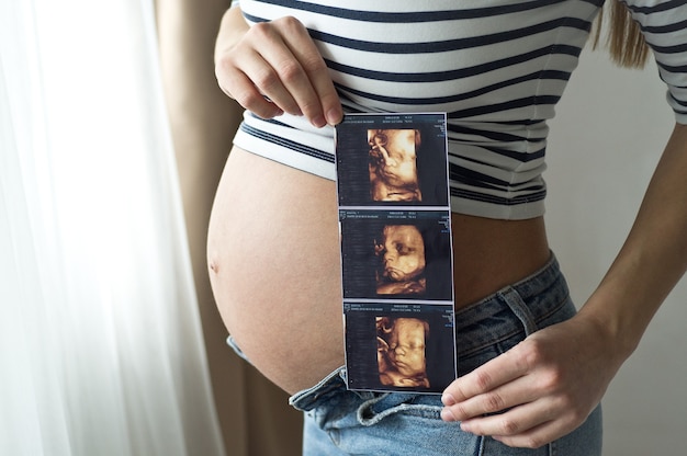 Immagine ecografica della holding della donna incinta. Concetto di gravidanza, assistenza sanitaria, ginecologia, medicina. Giovane madre che aspetta il bambino