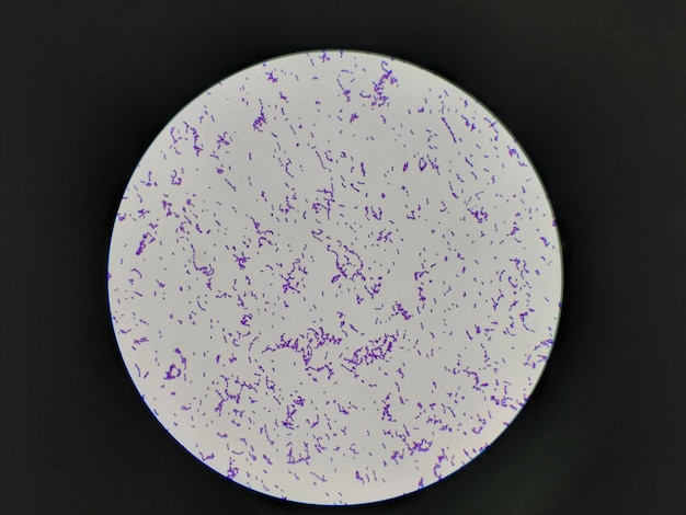 Immagine microscopica macchiata con grammo della colonia di Staphylococcus aureus