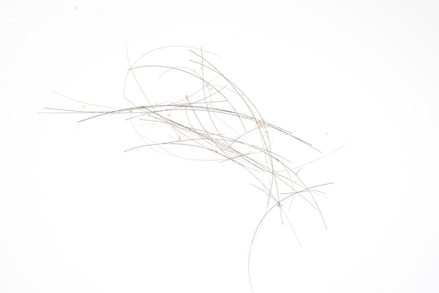 immagine ravvicinata di capelli con forfora