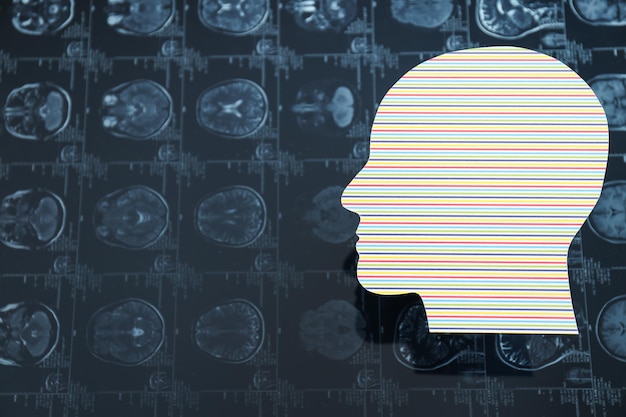 Immagini di MRI o risonanza magnetica con una testa umana di carta