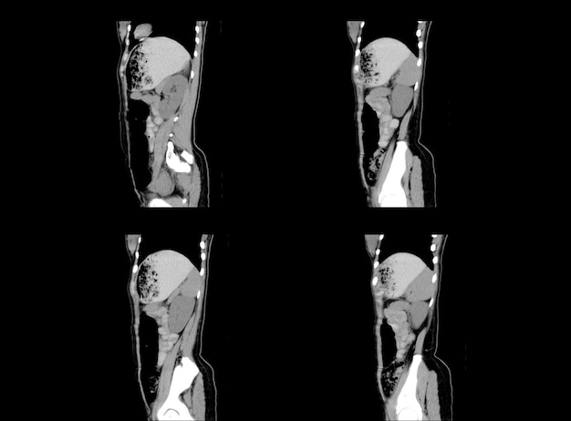 Immagini professionali di TAC e risonanza magnetica dell'addome