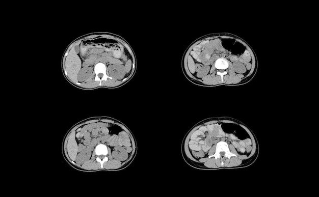 Immagini professionali di TAC e risonanza magnetica dell'addome