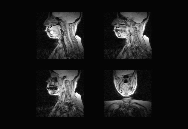 Immagini professionali per risonanza magnetica e TC della colonna vertebrale cervicale