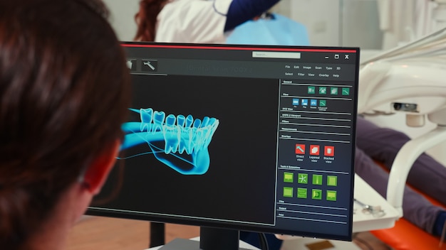 Infermiera stomatologo guardando l'impronta digitale dentale sul computer seduto in clinica stomatologica mentre il medico di odontoiatria sta lavorando con il paziente in background esaminando i problemi dei denti.
