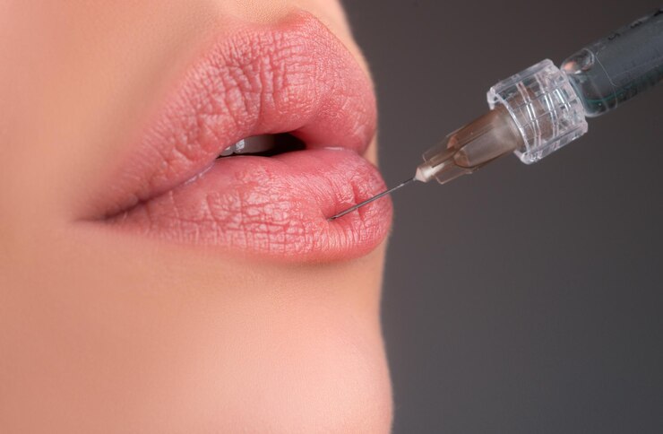 Foto ingrandimento delle labbra siringa bocca femminile iniezione di acido ialuronico cambiamenti di età cosmetologia trattamento