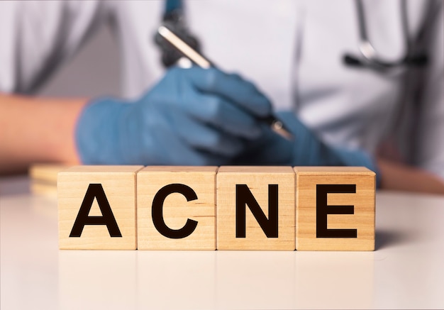 Iscrizione di parola di acne su carta nelle mani del medico