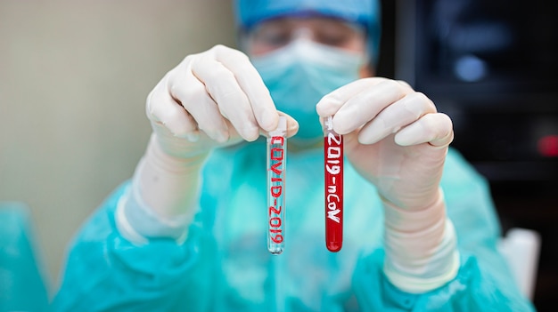 l'assistente di laboratorio tiene le provette con il vaccino contro il coronavirus nel suo esame del sangue della mano