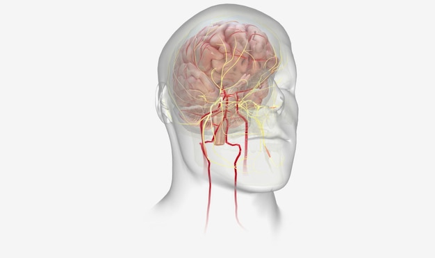 L'emicrania è un disturbo neurologico caratterizzato da ricorrenti