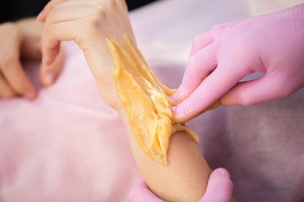 L'estetista fa lo zucchero per una ragazza, strappa bruscamente la pasta di zucchero dalla sua mano rimuovendo i peli superflui. L'estetista rimuove i capelli dalla mano di una donna