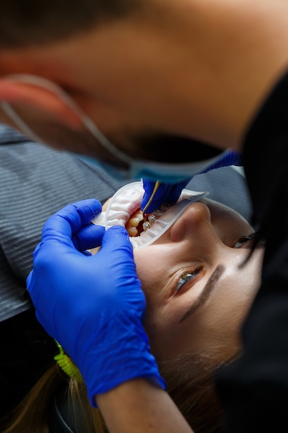 L'ortodontista mette bretelle metalliche sui denti del paziente. Trattamento odontoiatrico ortodontico. Foto di alta qualità