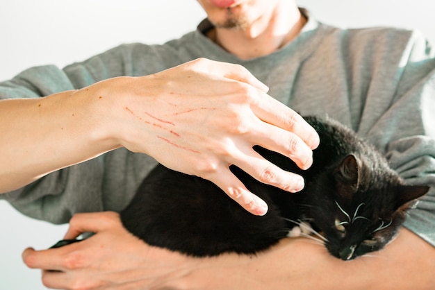 L'uomo mostra graffi di gatto su una mano e tiene il gatto nero nell'altra mano. Ferire. Dolore. Dolore. Cicatrici da animale domestico. Doloroso. Attaccato. Gatto arrabbiato