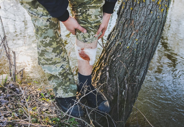 L'uomo sta mettendo la benda sulla ferita sanguinante. Gamba ferita. Turista nella natura. Pericolo di infezione. Trattamento medico. Trauma escursionistico.