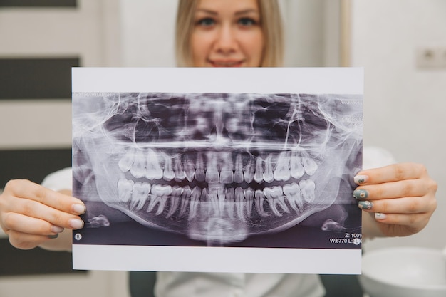 La bella ragazza paziente sta tenendo una radiografia dei suoi denti. concetto di medicina e odontoiatria.