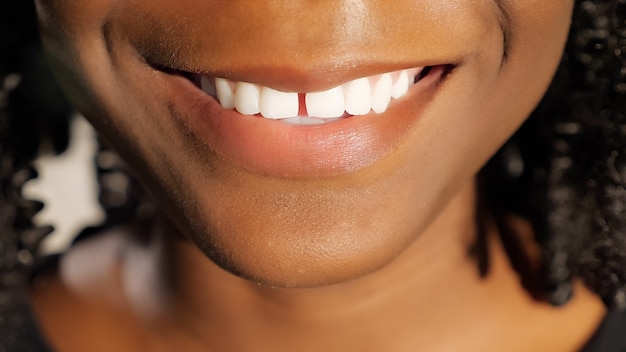 La donna africana abbastanza giovane con i capelli ricci neri sorride mostrando il primo piano dei denti bianchi