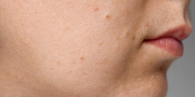 La donna ha i baffi sopra il primo piano del labbro superiore di peli facciali neri