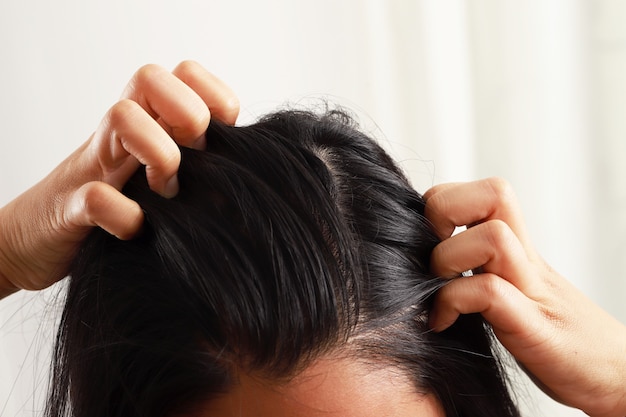 La donna ha prurito al cuoio capelluto, capelli grassi e perdita di capelli