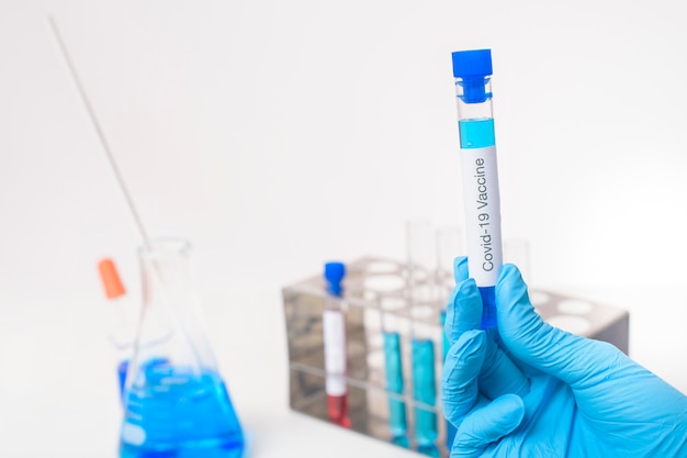 La mano di medico da vicino sta tenendo il vaccino covid-19 in laboratorio