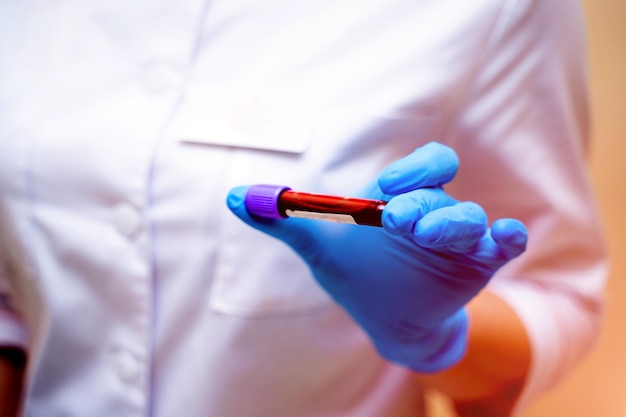 La mano di un medico in guanti blu tiene una provetta con un campione di sangue Analisi biochimica in laboratorio Concetto di assistenza sanitaria Messa a fuoco selettiva
