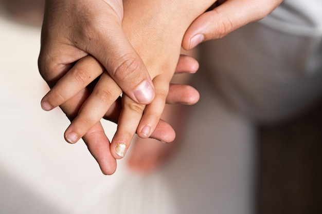 La mano di un ragazzo con un chiodo scheggiato Unghia dolorosa persa vista macro ferita