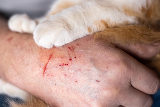 La mano graffiata del proprietario dell'animale e le zampe del gatto