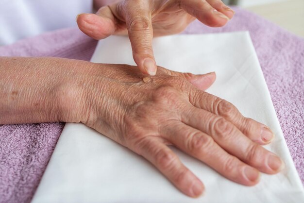 La nonna delle mani della donna anziana del primo piano strofina un unguento riscaldante per l'artrite