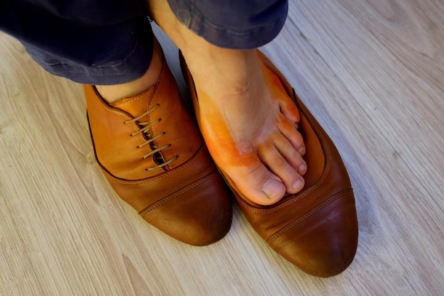 La pelle della donna sui piedi è di colore arancione con le scarpe bagnate