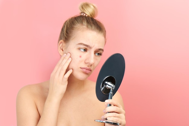 La ragazza sconvolta si guarda allo specchio la sua pelle problematica con acne rossa e post-acne isolata su uno sfondo rosa
