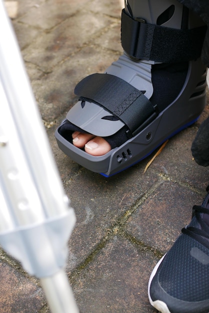 Le donne hanno rotto i piedi con uno stivale di plastica grigio che protegge le lesioni dalla caviglia