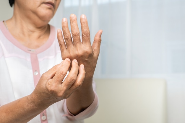 Le donne senior graffiano passano il prurito sul concetto del braccio, di sanità e della medicina dell'eczema