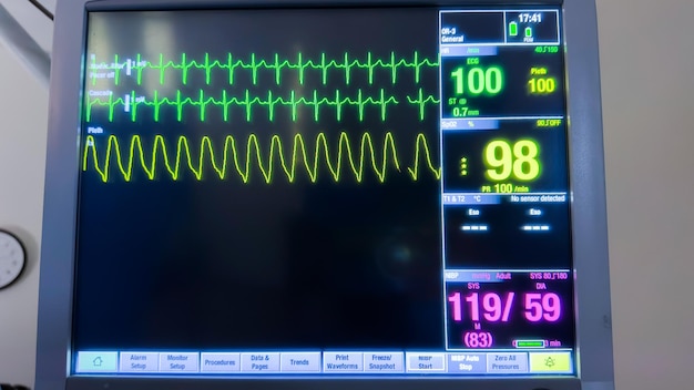 Le macchine per monitor ospedalieri simboleggiano l'importanza del monitoraggio continuo di segni vitali come