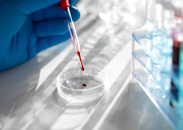 Le mani dei ricercatori in laboratorio stanno lavorando a un vaccino contro la goccia di sangue del virus in un d...