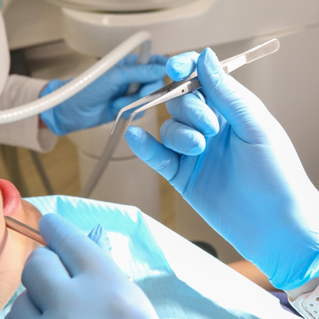 le mani del dentista che cura il paziente