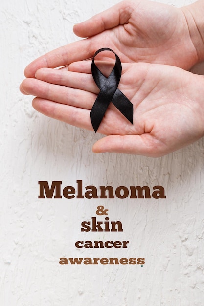 Le mani della donna tengono il nastro nero per il simbolo Melanoma e cancro della pelle