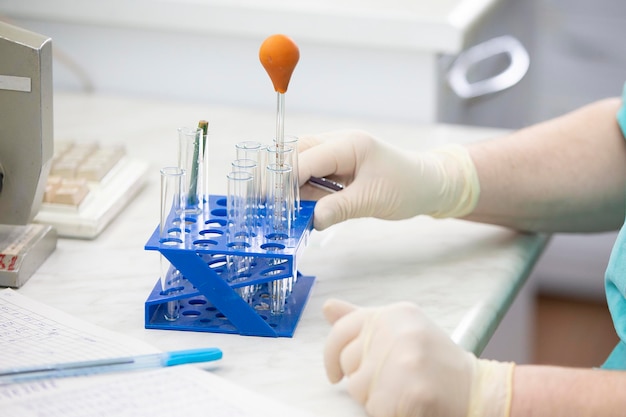 Le mani di un assistente medico-laboratorio con guanti di gomma tengono le provette di vetro.