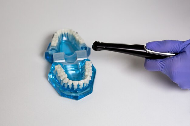 Le parentesi graffe dei denti campione di odontoiatria