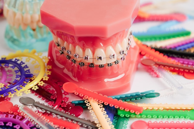 Legature ortodontiche anelli e fascette elastiche in gomma su apparecchi ortodontici modello per dentista che studia odontoiatria