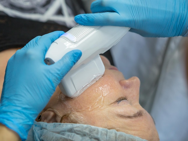 Lifting facciale non chirurgico SMAS lifting ultrasonico Il processo di ringiovanimento Cosmetologia hardware