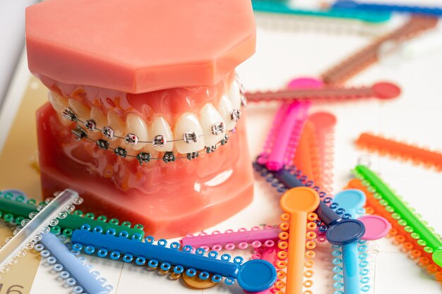 Ligature ortodontiche anelli e legami nastri elastici su apparecchi ortodontici modello per dentisti che studiano odontoiatria