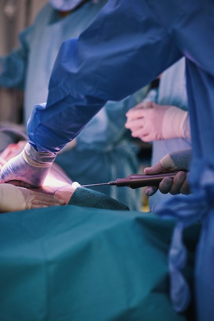 Liposuzione in sala operatoria