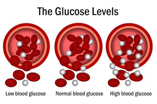 Livello di glucosio con il vaso sanguigno