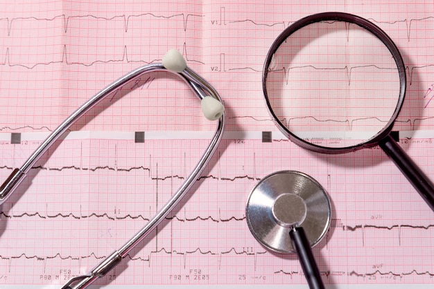 Lo stetoscopio e la lente d'ingrandimento si trovano sul foglio con l'elettrocardiogramma. concetto medico.