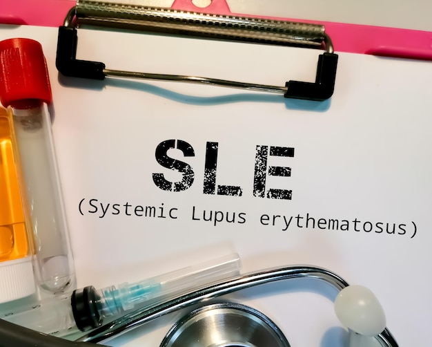 Lupus eritematoso sistemico isolato con apparecchiature mediche su una clipboard