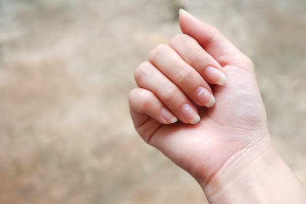 Macchia bianca sull'unghia della donna, rivelata sulla salute causata dalla carenza di calcio. Questa malattia è chiamata leuconichia.