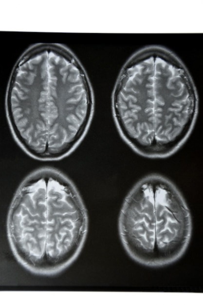 Macrofotografia della tomografia computerizzata con il cervello Risonanza magnetica medica scientifica ed educativa del cervello