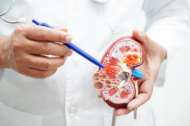 Malattia renale cronica modello medico in possesso per il trattamento del sistema urinario urologia Tasso di filtrazione glomerulare stimato eGFR