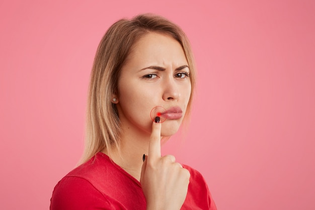 Malcontenta giovane femmina con sguardo infelice, ha herpes orale, indica alla ferita vicino alle labbra, sta lateralmente contro il rosa. Concetto di persone, cura della pelle e problemi di salute.